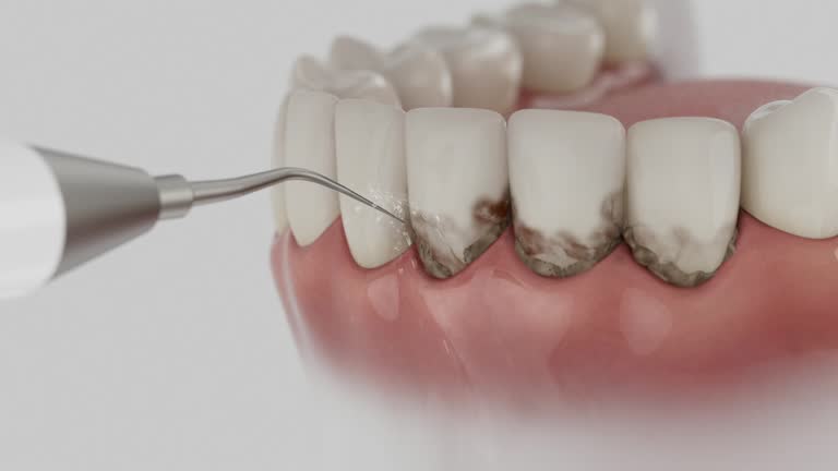 Reliable Teeth Cleaning And Checkup contractor in Covington County County, MS by Dentist Open Now